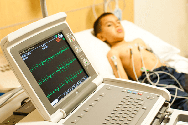 ECG Tests – Before, During and After