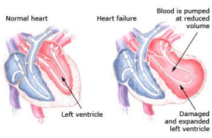Heart Failure check up in bani park