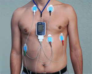 holter check up facilities in rajasthan