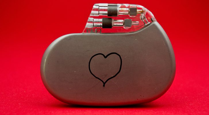 All You Need to Know about Getting a Pacemaker