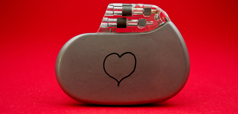 All You Need to Know about Getting a Pacemaker